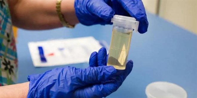 İşe alımlarda ‘uyuşturucu testi’ periyodu… Kamu kurumları da talep ediyor